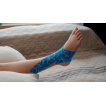 Bunions - otroci